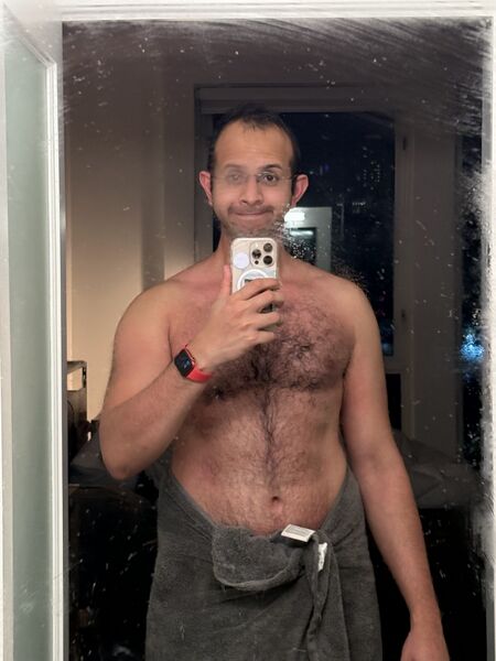 File:Roshan With Hives Again.jpg